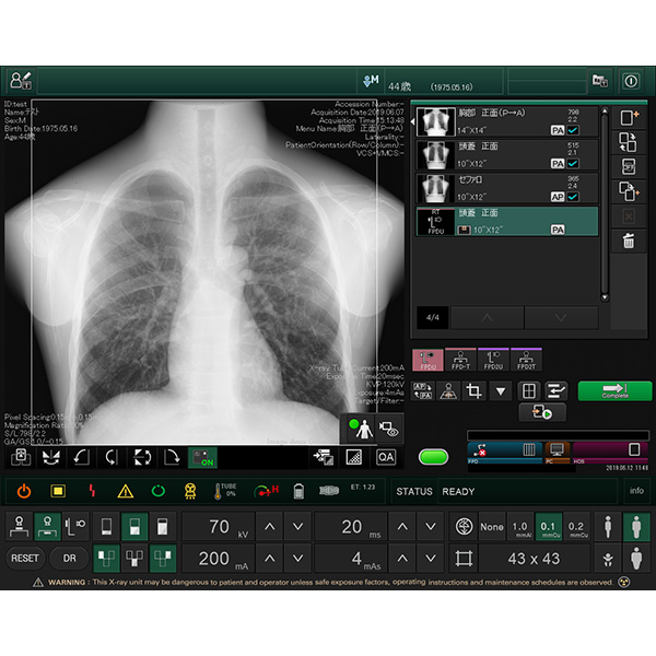 X-ray Diagnostic System