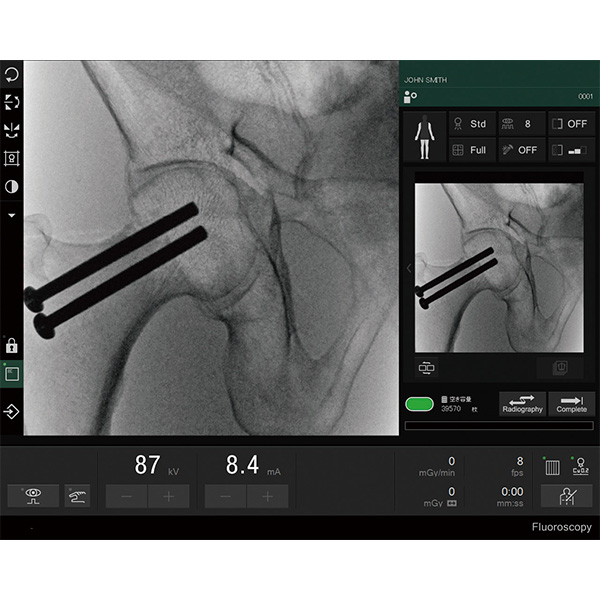 X-ray Fluoroscope